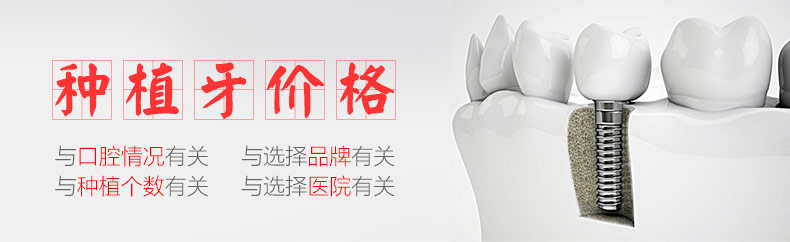 种植牙价格表