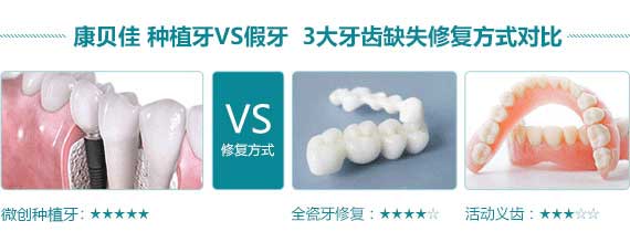 无锡老人装假牙价格是多少